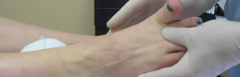 The assessment of the range of motion the 1st toe joint
